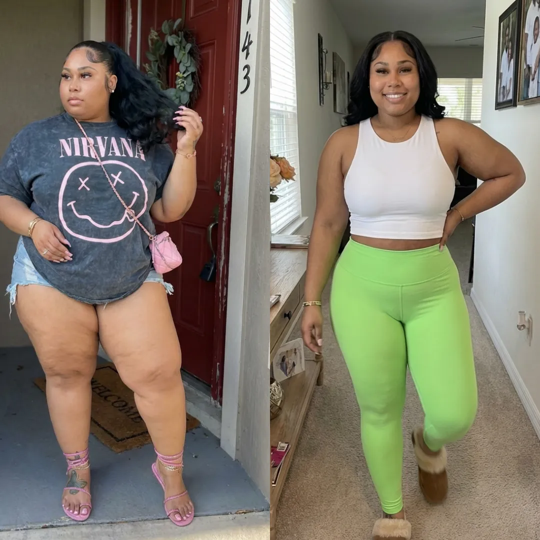 An Everglow Miami patient before and after