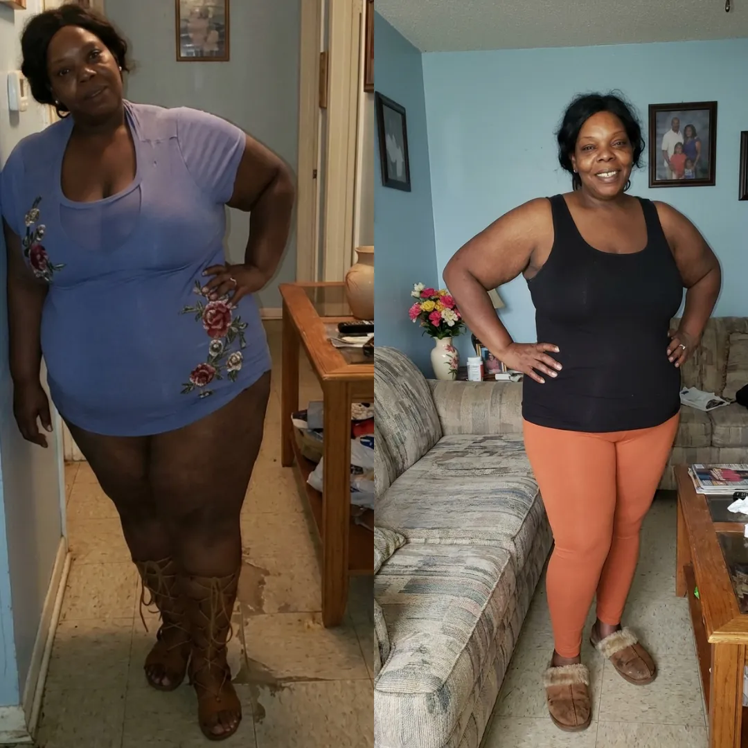 An Everglow Miami patient before and after