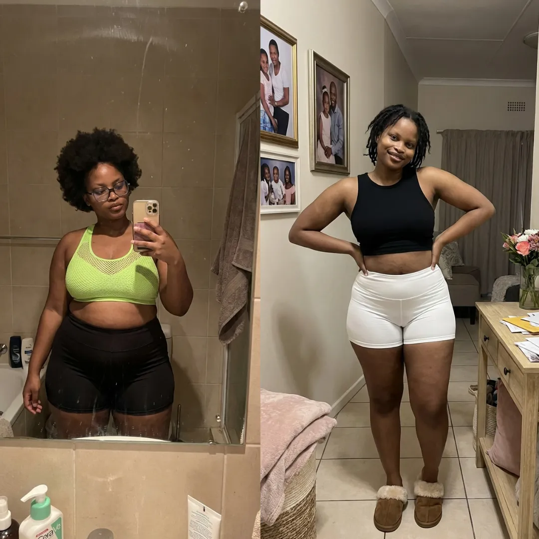 An Everglow Miami patient before and after