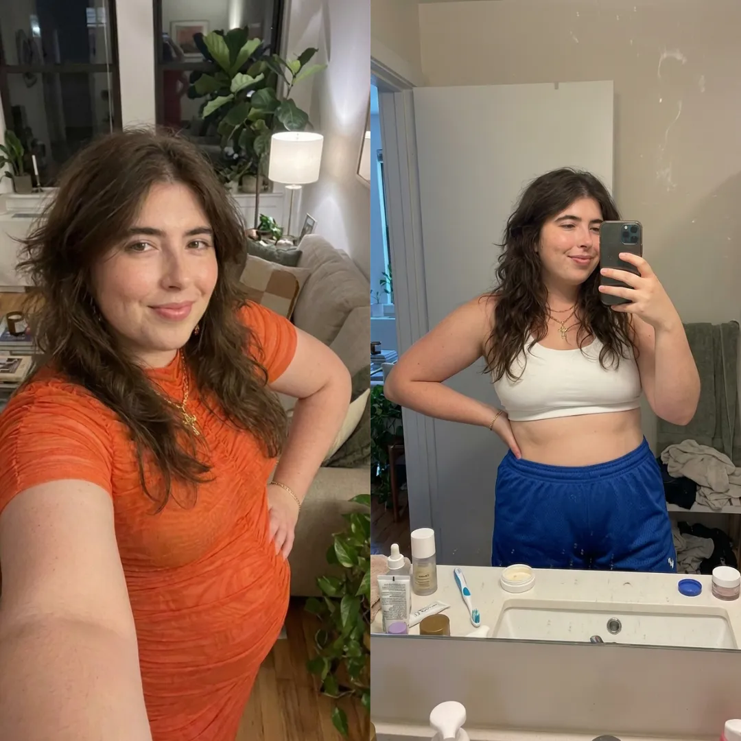 An Everglow Miami patient before and after